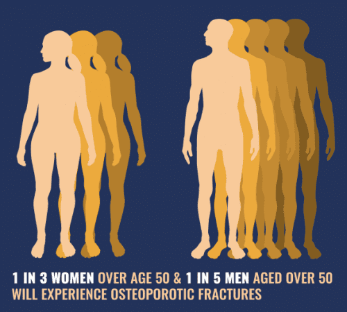 Infographic showing 1 in 3 women and 1 in 5 men over 50 will experience osteoporosis fractures. Encouraged to see our endocrinology specialty doctor in Idaho Falls and Pocatello.
